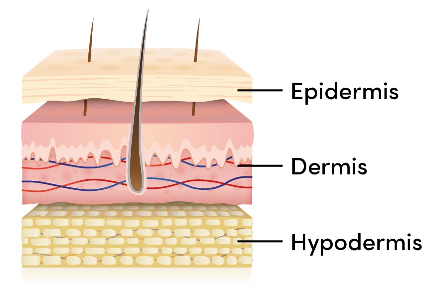 Image of the three layers of the skin, epidermis, dermis and hypodermis.